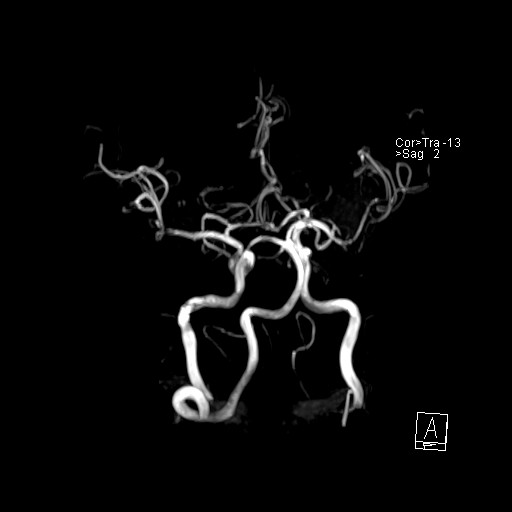 Click on the Serie image to view the images of VILLANUEVA, WILLIAM A.